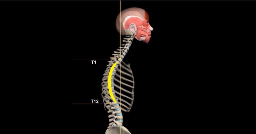 Kyphosis