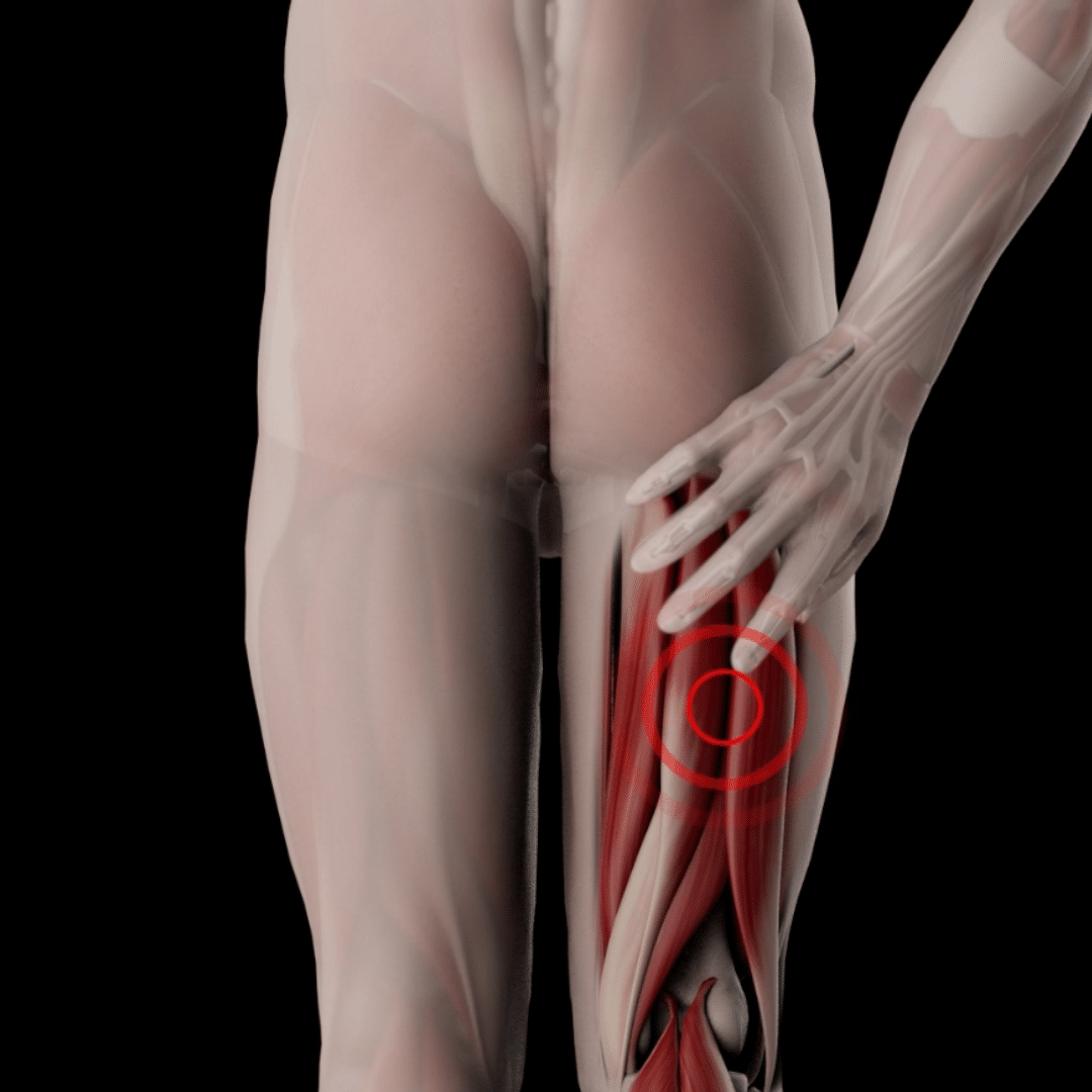 Hamstrings_pain