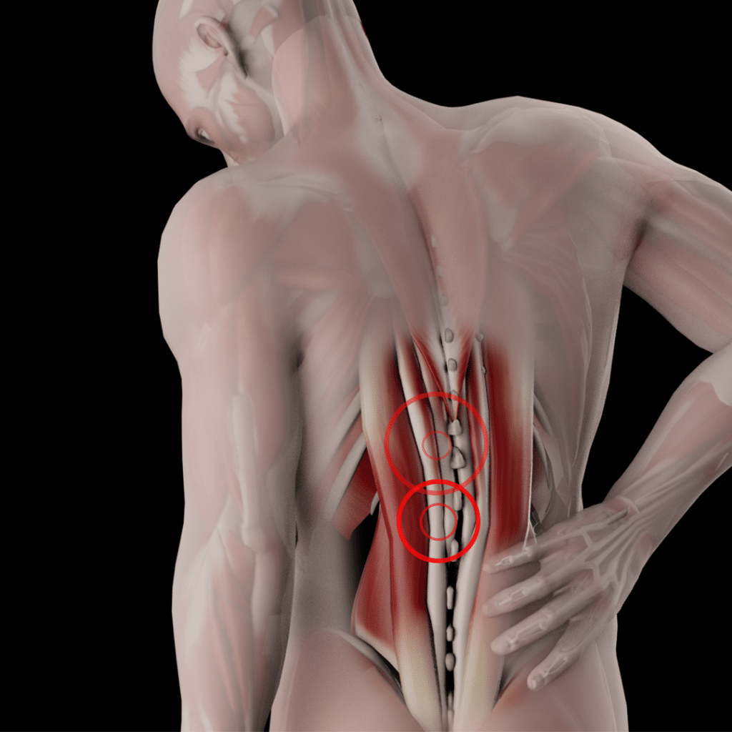 Back_pain