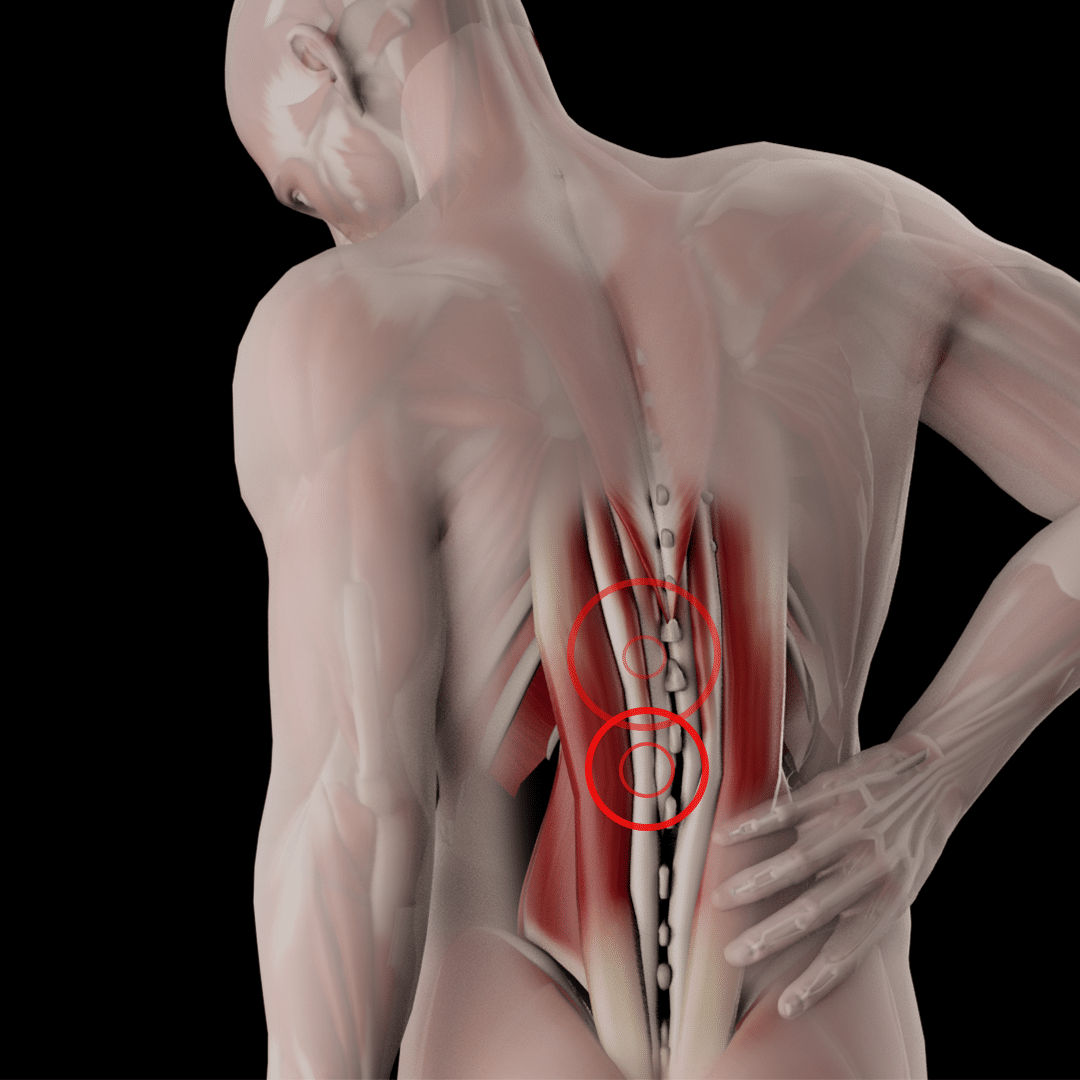 Back_pain