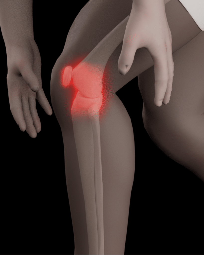 Knee_pain_