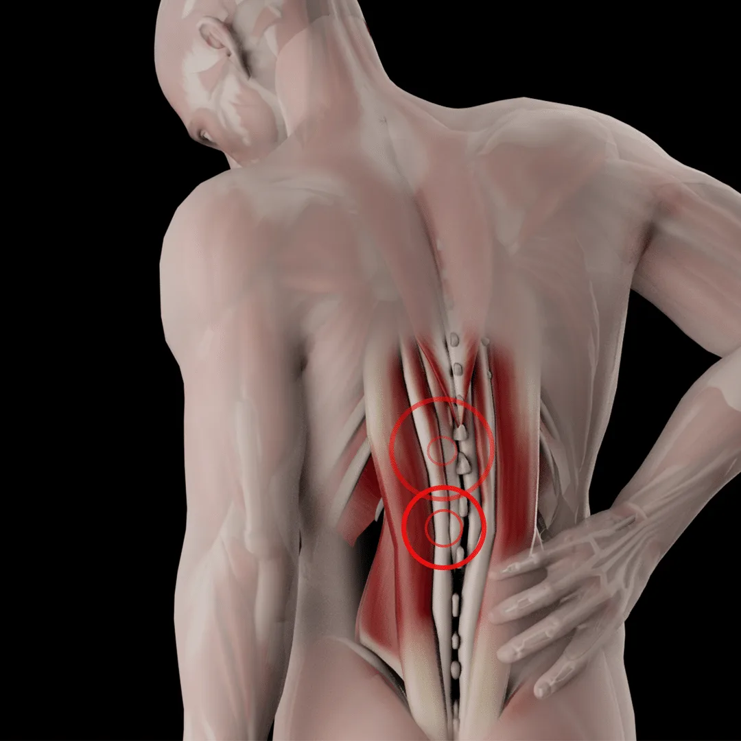 Back_pain