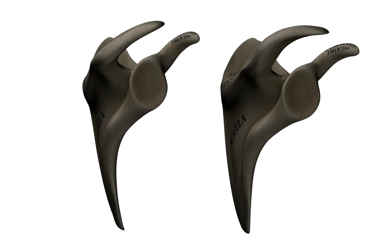 Comparison of curved and flat acromion shapes on two scapulae